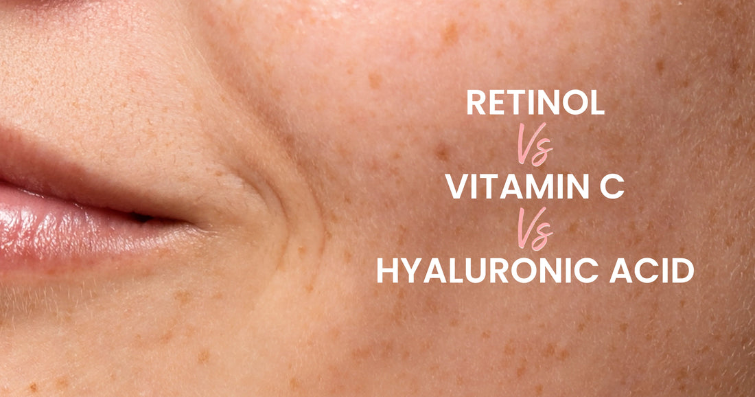 Retinol, Vitamin C, and Hyaluronic Acid: A Complete Comparison