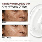 Hyaluronic Serum